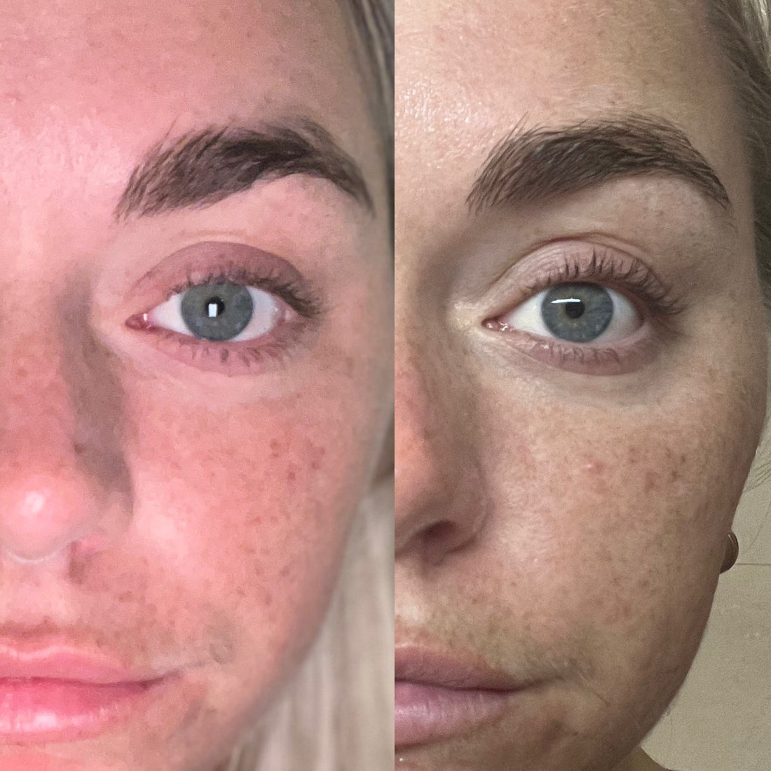 before_after_eyelashserum